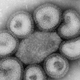 Virus Influenza al microscópio electrónico. Foto: AP